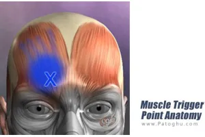 دانلود نرم افزار Muscle Trigger Point Anatomy v2.4.1 آناتومی تورم نقطه عضلانی برای اندروید