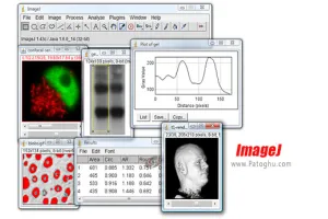 دانلود نرم افزار ImageJ 1.52v برنامه عالی آنالیز تصاویر