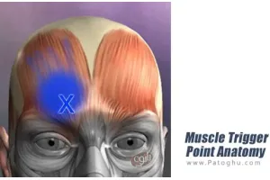 دانلود نرم افزار Muscle Trigger Point Anatomy v2.4.1 آناتومی تورم نقطه عضلانی برای اندروید