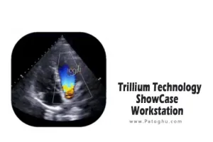 دانلود نرم افزار Trillium Technology ShowCase Workstation 6.6.2.1 برنامه مدیریت تصاویر پزشکی به صورت سریع و اثربخش